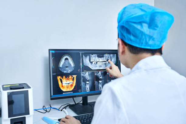 Best Dental Abscess Treatment in Kissimmee, FL